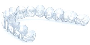 Clear Aligners